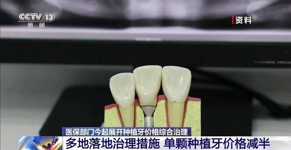 价格大降50%！今日起<strong></p>
<p>USDT今日价格</strong>，落实