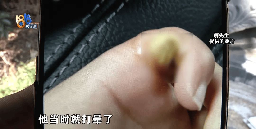 5岁男童瞬间晕厥<strong></p>
<p>证券公司工作</strong>，筋都断了！街上常见，看见立即远离