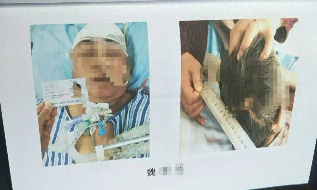 目睹母亲过马路被车撞<strong></p>
<p>证券资管</strong>，27岁女子受惊吓5天后身亡