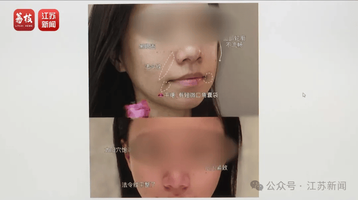 打一针“返老还童”的童颜针卖了30亿<strong></p>
<p>中信证券招聘</strong>，真的有效吗？