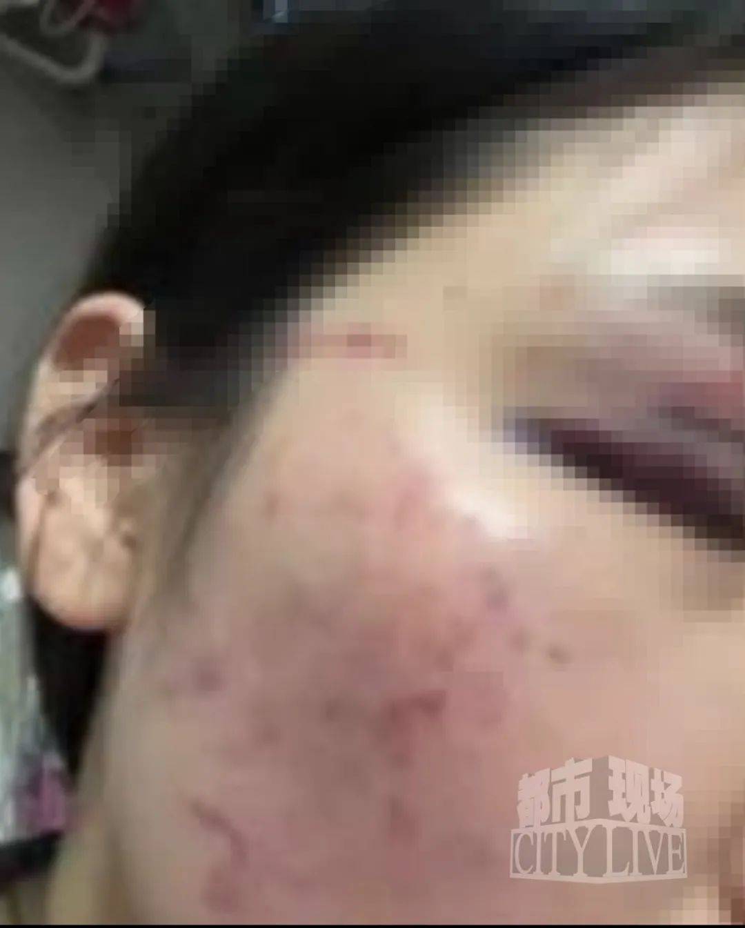 湖南衡阳29岁女子疑被男友施暴后从25楼跳下身亡 男友徐某此前还刺激说：“你放心<strong></p>
<p>证券执业</strong>，她不会去死的”